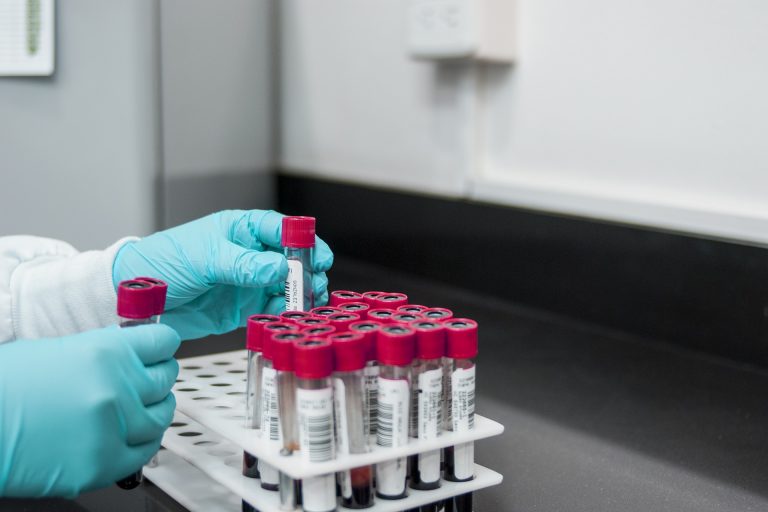 sangue laboratorio analisi