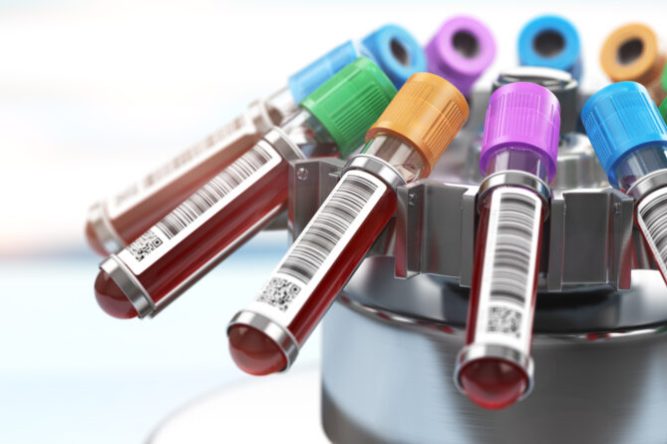 Blood test tubes in centrifuge. Plasma preparation in medical  h