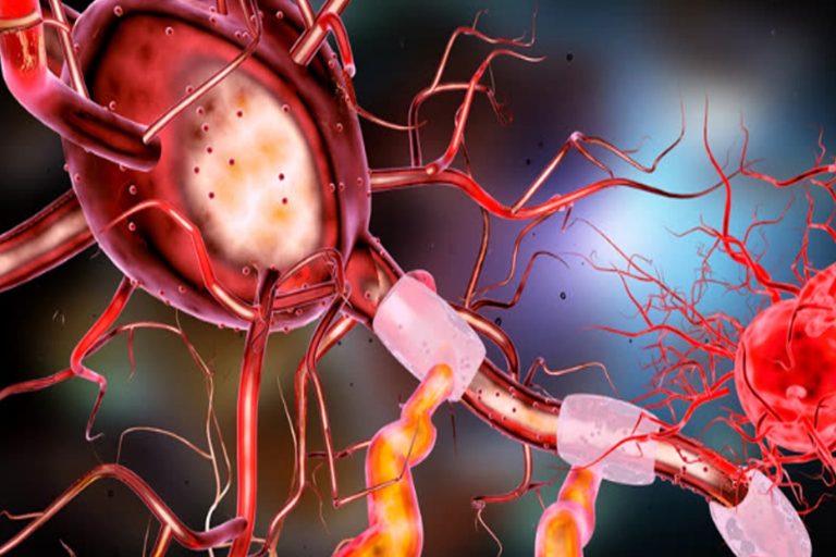 NEUROLOGIA