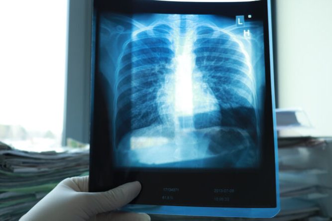 WhatsApp Image 2023-09-25 at 09.32.43