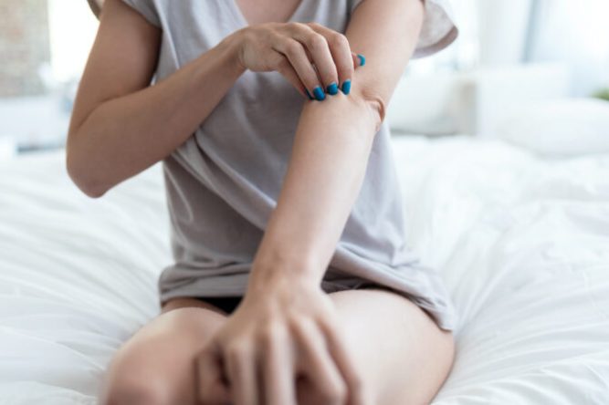 Young woman sitting on the bed while scratching her arm. Psorias