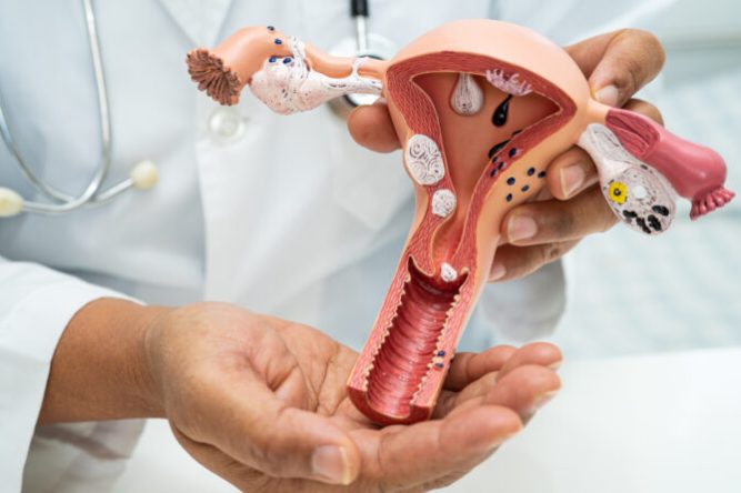 Uterus, doctor with anatomy model for study diagnosis and treatm